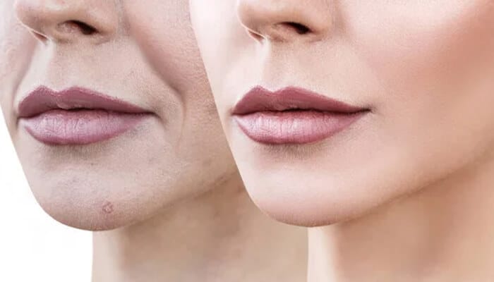 Before and after results highlighting natural remedies in How To Tighten Face Skin Naturally At Home for firmer, youthful skin.