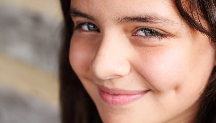 Cheek dimples fovea buccalis - Fashion in beauty - Fashion in Beauty Close-up of a young girl with a smile showing a deep cheek dimple, demonstrating one of the types of dimples