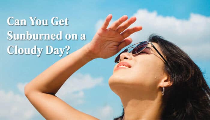 Can You Get Sunburned on a Cloudy Day? - Fashion In Beauty - Fashion in Beauty Can You Tan Through Clouds: realistic image of a woman shielding her face under bright sunlight on a cloudy day, illustrating how UV rays penetrate cloud cover and increase sunburn and tanning risk even without direct sun exposure.