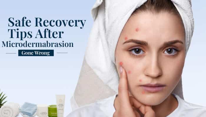 Safe Recovery Tips After Microdermabrasion Gone Wrong - Fashion In Beauty - Fashion in Beauty Microdermabrasion Gone Wrong recovery image showing acne-like bumps and irritated skin, highlighting gentle aftercare, sun protection, and barrier repair.