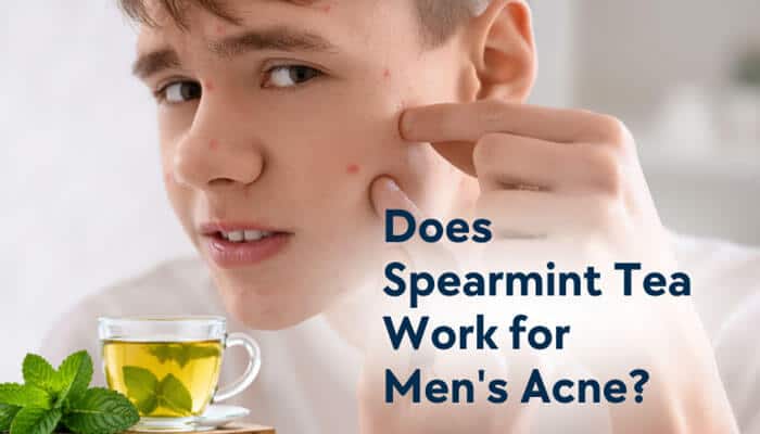 Does Spearmint Tea Work for Mens Acne - Fashion In Beauty - Fashion in Beauty Spearmint Tea for Acne shown as a potential natural approach for male hormonal acne, featuring a young man with visible facial breakouts and a glass of spearmint herbal tea, highlighting research into spearmint’s anti-androgenic properties that may help regulate excess sebum production linked to acne formation.
