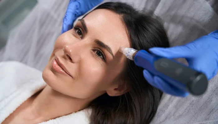 Microneedling Aftercare - Fashion in beauty - Fashion in Beauty Woman receiving a facial treatment with a handheld device applied to her forehead by gloved hands, lying down and relaxed.