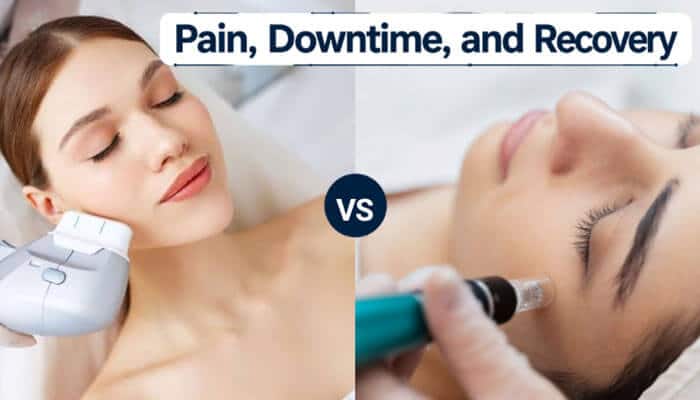 Pain Downtime and Recovery - Fashion In Beauty - Fashion in Beauty Ultherapy vs Microneedling comparison showing facial treatment procedures to illustrate differences in pain, downtime, recovery, and skin rejuvenation.