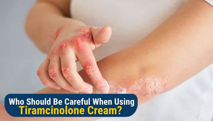 Who Should Be Careful When Using Triamcinolone Cream - Fashion In Beauty - Fashion in Beauty What Is Triamcinolone Cream 0.1 Used to Treat showing a person applying topical corticosteroid cream for inflamed skin conditions while highlighting precautions for sensitive skin, eczema, dermatitis, itching, redness, and irritation management with medical guidance.